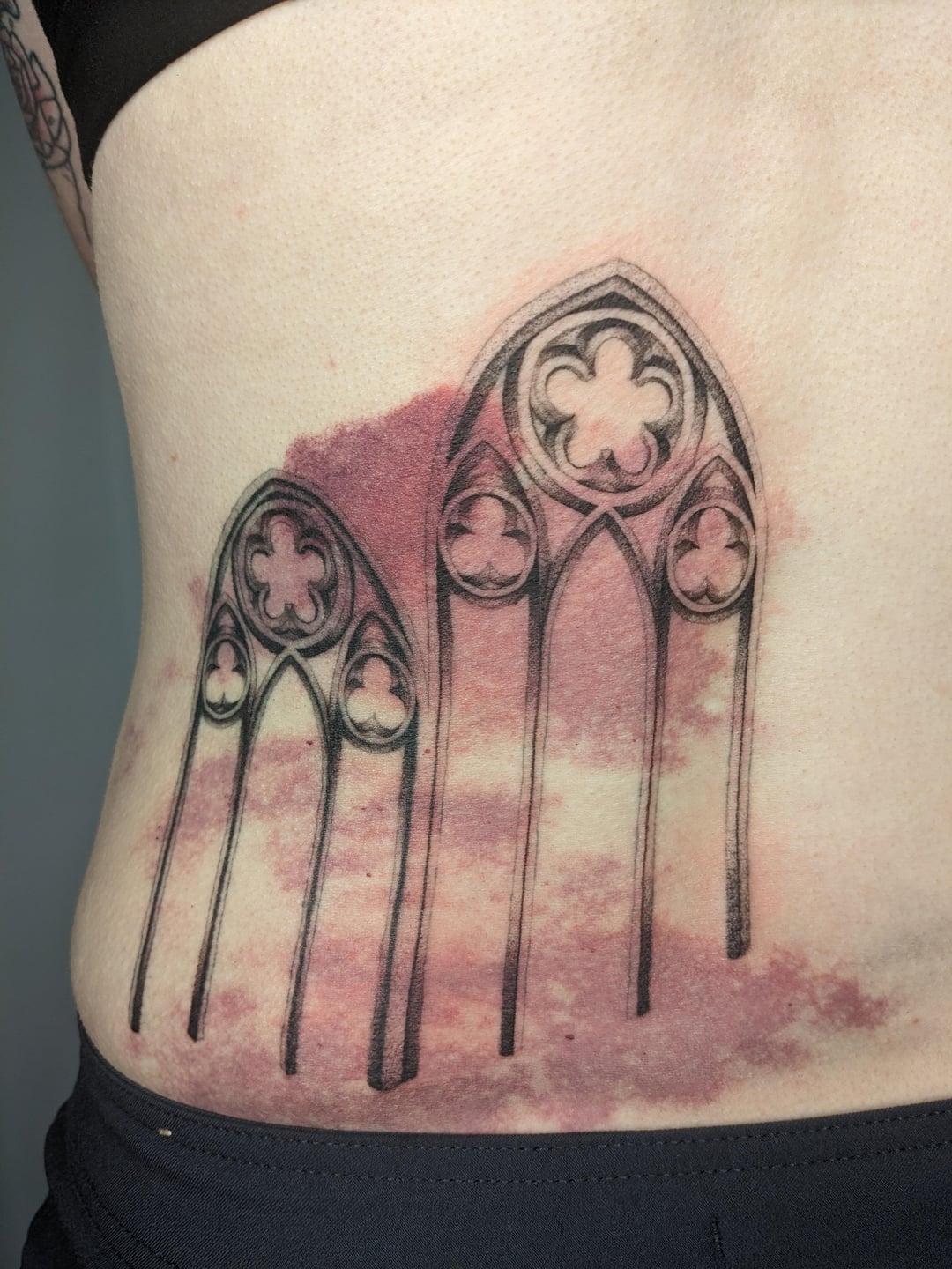 Birthmark tattoo done by titcrab at Yours Truly Tattoo, Portland, OR